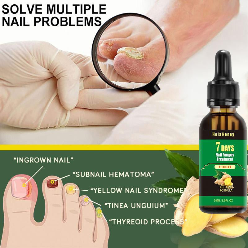 Hola Honey 7 Days Ginger Nail , Moisturizes and Thickens Nails - Longer, Stronger and Brighter Nails with Vitamins B and E